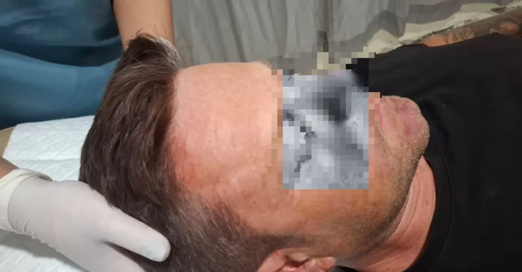 Victims of violence committed by bali immigration officers