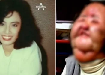 Photo Before and After face of Han Mi Ok