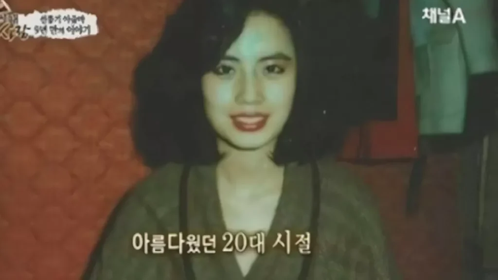 When Beauty Standards Break a Life: The Han Mi Ok Story and Bali's Illegal Clinics Risk 38
Photo of Han Mi Ok's face before surgery (Doc Ist)