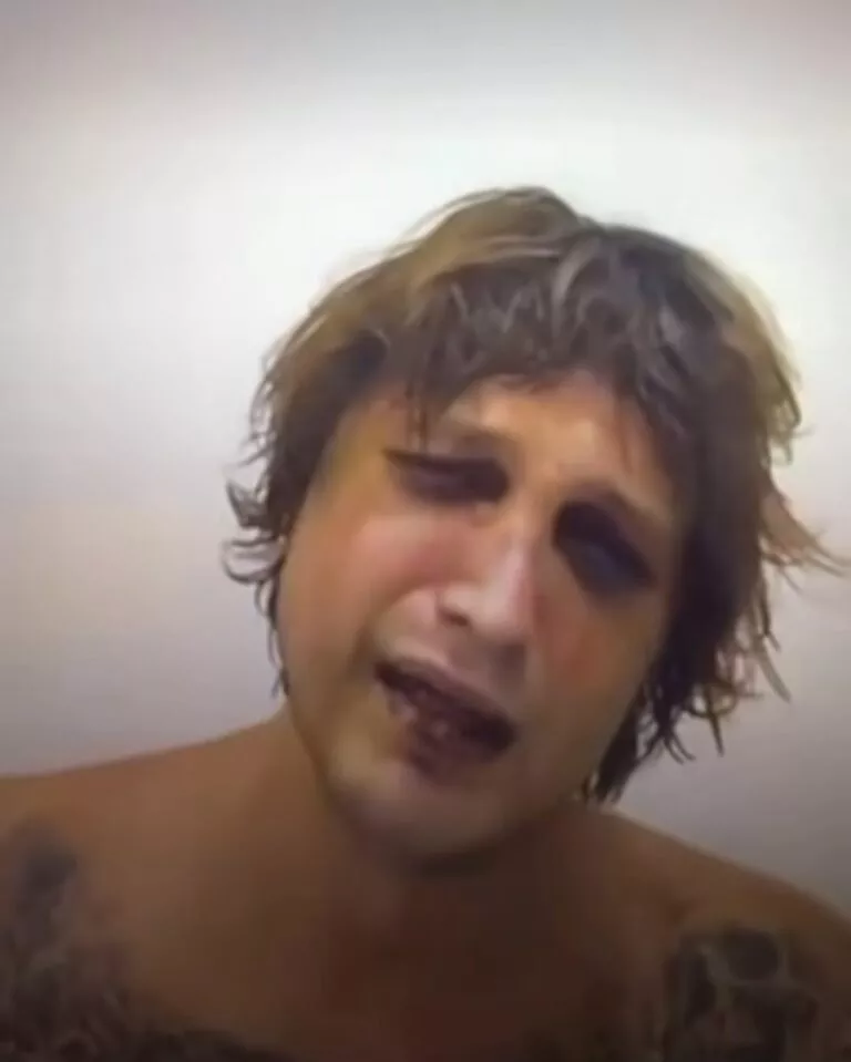 Bali Ukrainian Murder Case: Victim Was Tracked for Weeks Before Abduction, Police Say 38 Photo of Ukrainian citizen who was the victim of kidnapping and murder in Bali (IST)