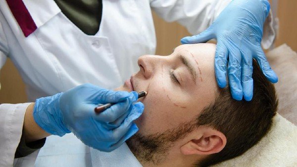 Beauty, Risk, and the Pursuit of Perfection: What the Death of an Estée Lauder Executive Reveals About Cosmetic Fillers 39 Illustration of filler injections.