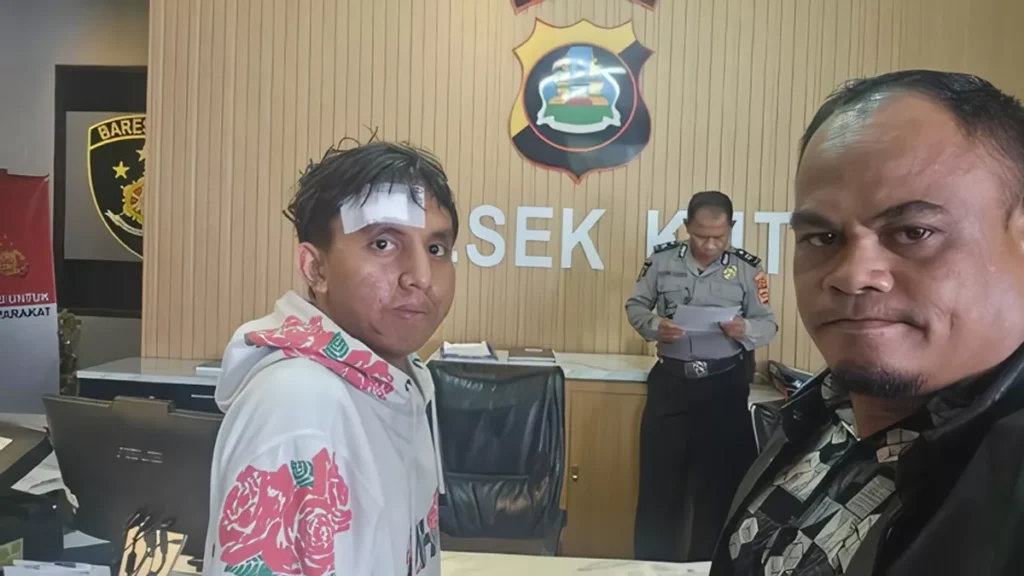 Tinder Job Offer in Bali Ends in Alleged Kidnapping and Extortion Case, Police Investigating 38
Photo of the victim (Krisno) after filing a police report regarding his kidnapping and assault, allegedly using a job offer in Bali. (Photo: Special Doc.)