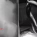 A Bangladeshi Fisherman's Stomach Pain Turned Out to Be a Live 65-Centimeter Eel Inside His Intestines 45 A live 65-centimeter (cm) eel was lodged inside a Bangladeshi man's intestine. (Photo: International Journal of Surgery Case Reports)