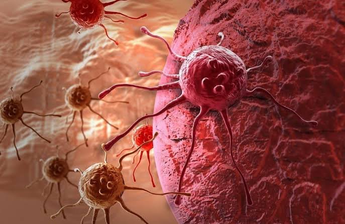 WHO Warns One in Five People Will Develop Cancer. But Millions of Cases Could Still Be Prevented. 38
Illustrative photo of cancer cells