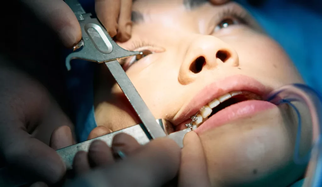 Close-up of tooth-in-eye surgery to implant an artificial cornea and restore vision after corneal blindness.