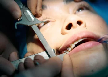 Close-up of tooth-in-eye surgery to implant an artificial cornea and restore vision after corneal blindness.