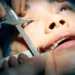 Close-up of tooth-in-eye surgery to implant an artificial cornea and restore vision after corneal blindness.